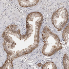 Immunohistochemical staining of human prostate shows moderate cytoplasmic positivity in glandular cells.