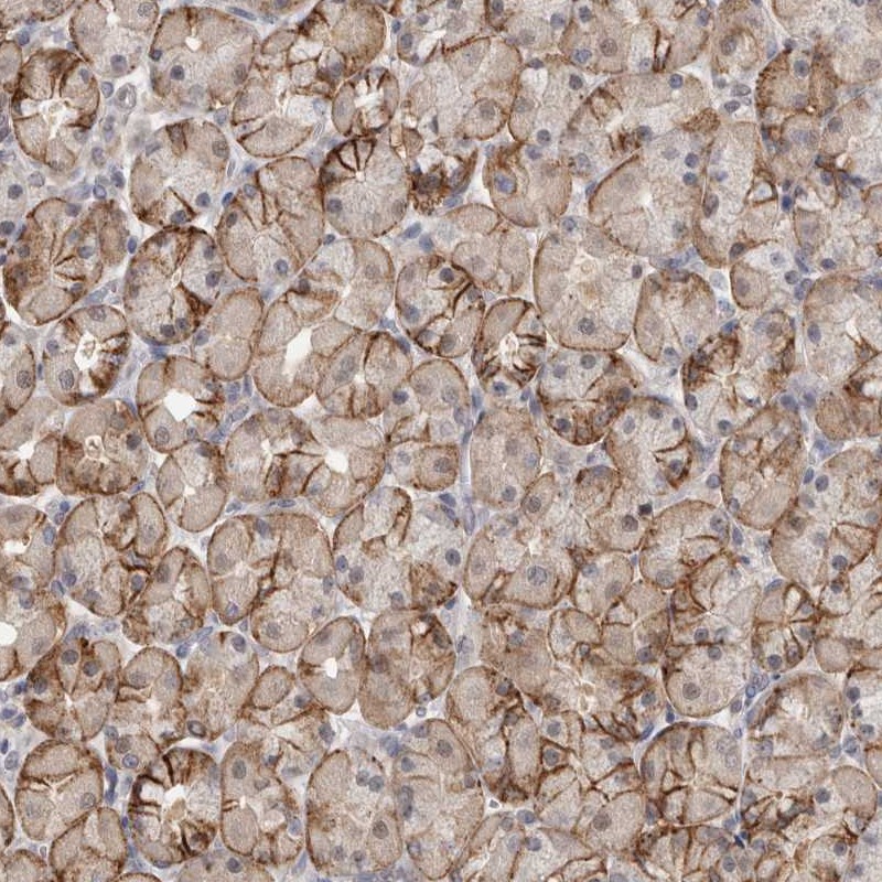 Anti-PIGP Antibody