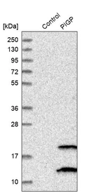 Western blot analysis in control (vector only transfected HEK293T lysate) and PIGP over-expression lysate (Co-expressed with a C-terminal myc-DDK tag (~3.1 kDa) in mammalian HEK293T cells, LY407008).
