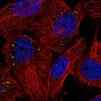 Immunofluorescent staining of human cell line U-251 MG shows localization to vesicles.