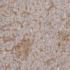 Anti-CLDN12 Antibody
