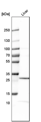 Western blot analysis in human liver tissue.