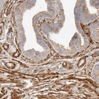 Anti-TMTC2 Antibody