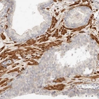Immunohistochemical staining of human prostate shows strong cytoplasmic positivity in smooth muscle cells.