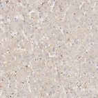 Immunohistochemical staining of human liver shows weak cytoplasmic positivity in hepatocytes.
