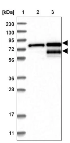 Lane 1: Marker [kDa] 230, 130, 95, 72, 56, 36, 28, 17, 11_br/_Lane 2: Human cell line RT-4_br/_Lane 3: Human cell line U-251MG sp