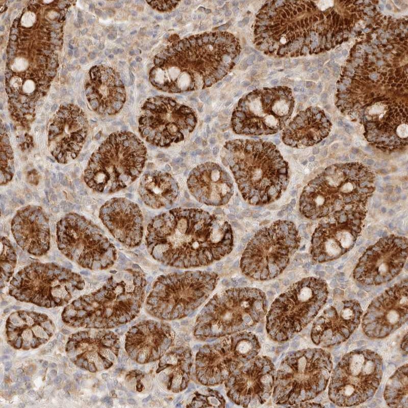 Anti-TMTC2 Antibody