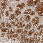 Anti-TMTC2 Antibody