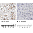 Anti-KCNJ1 Antibody