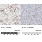 Anti-KCNJ1 Antibody