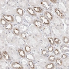 Immunohistochemical staining of human kidney shows strong membranous positivity in cells in distal tubules.