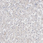 Immunohistochemical staining of human liver shows no positivity in hepatocytes as expected.