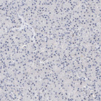 Immunohistochemical staining of human pancreas shows no positivity in exocrine glandular cells as expected.