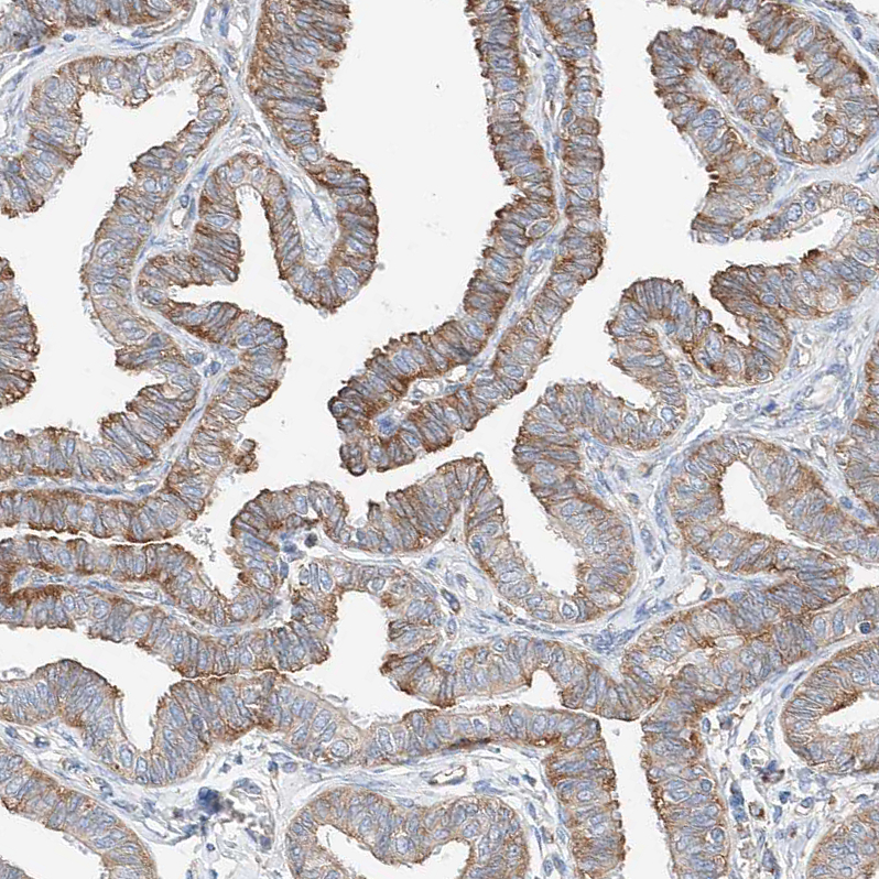 Anti-CRELD1 Antibody