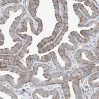 Anti-CRELD1 Antibody