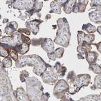 Immunohistochemical staining of human placenta shows moderate granular cytoplasmic positivity in trophoblastic cells.