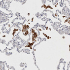 Immunohistochemical staining of human lung shows strong granular cytoplasmic positivity in macrophages.