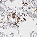 Immunohistochemical staining of human lung shows strong granular cytoplasmic positivity in macrophages.