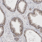 Immunohistochemical staining of human prostate shows moderate to strong granular cytoplasmic positivity in glandular cells.