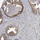 Anti-CMTM6 Antibody