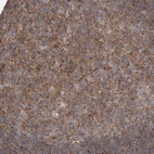 Immunohistochemical staining of human lymph node shows moderate membranous positivity in germinal center cells.