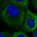 Immunofluorescent staining of human cell line A-431 shows localization to cytosol & intermediate filaments.