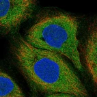 Anti-LILRB3 Antibody