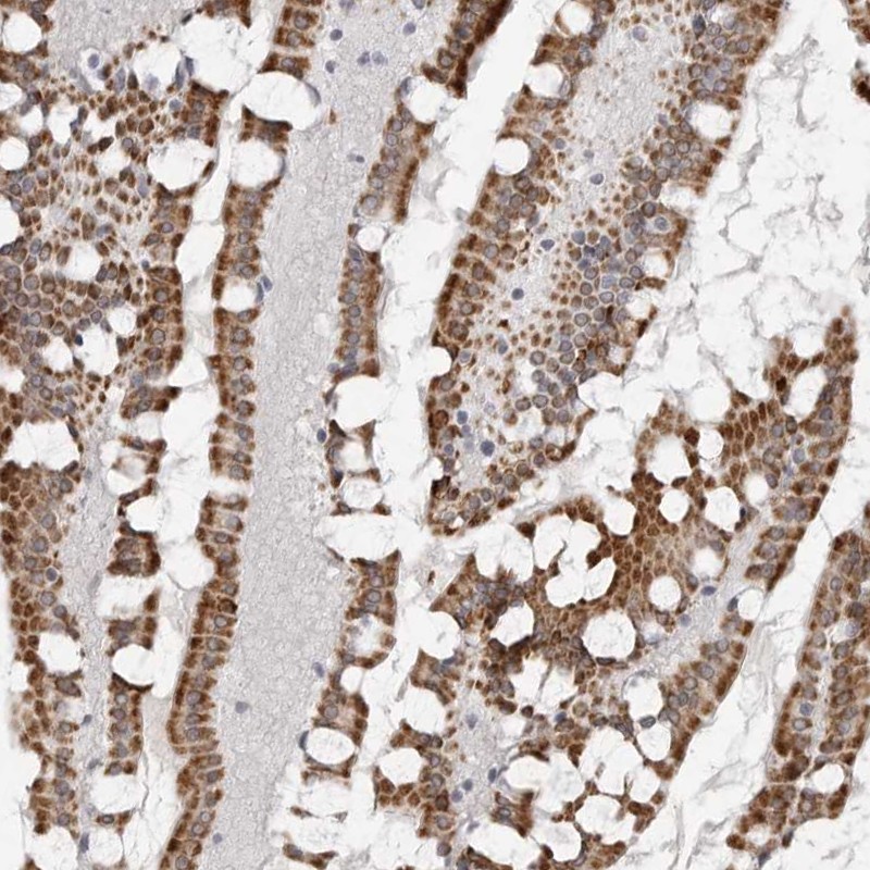 Anti-TCTN3 Antibody