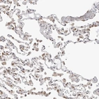 Immunohistochemical staining of human lung shows moderate nuclear positivity in macrophages.
