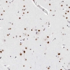 Immunohistochemical staining of human cerebral cortex shows strong nuclear positivity in neuronal cells.