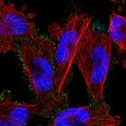 Immunofluorescent staining of human cell line U-251 MG shows localization to plasma membrane.