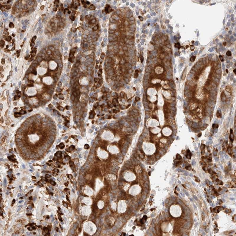 Anti-UTS2B Antibody