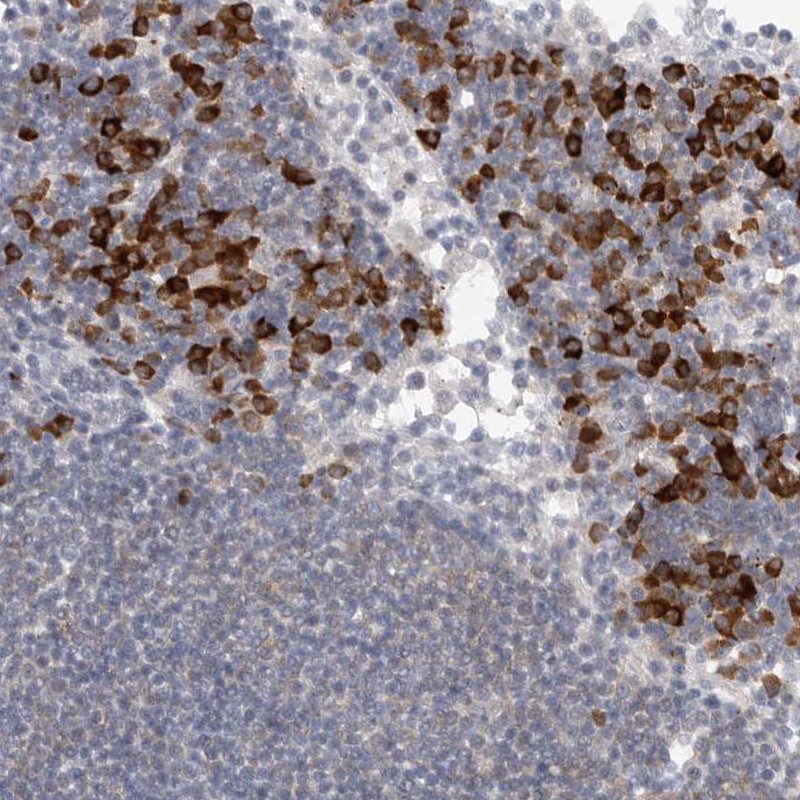 Anti-TMEM69 Antibody