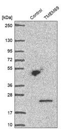 Anti-TMEM69 Antibody