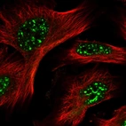 Immunofluorescent staining of human cell line U-251 MG shows localization to nuclear speckles.