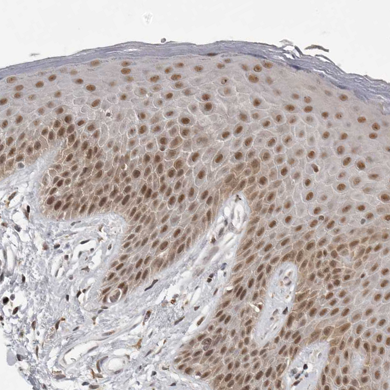 Anti-PRDM10 Antibody