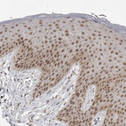 Anti-PRDM10 Antibody