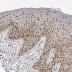 Anti-PRDM10 Antibody