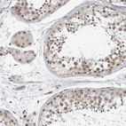 Immunohistochemical staining of human testis shows moderate nuclear positivity in cells in seminiferous ducts.