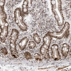 Immunohistochemical staining of human duodenum shows strong nuclear positivity in glandular cells.
