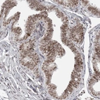 Immunohistochemical staining of human Fallopian tube shows moderate nuclear positivity in glandular cells.