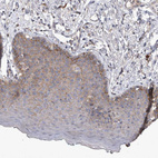 Anti-SRD5A3 Antibody