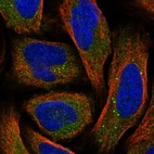 Immunofluorescent staining of human cell line U-2 OS shows positivity in cytoplasm & vesicles.