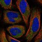 Immunofluorescent staining of human cell line U-2 OS shows positivity in cytoplasm & vesicles.