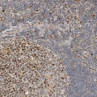 Anti-CSNK1G3 Antibody