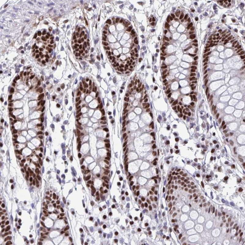 Anti-SLC35C2 Antibody