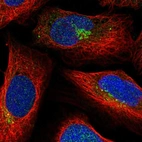 Immunofluorescent staining of human cell line U-2 OS shows localization to the Golgi apparatus.