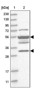 Lane 1: Marker [kDa] 230, 130, 95, 72, 56, 36, 28, 17, 11_br/_Lane 2: Human cell line RT-4
