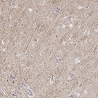 Anti-KCNJ12 Antibody