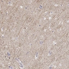 Anti-KCNJ12 Antibody